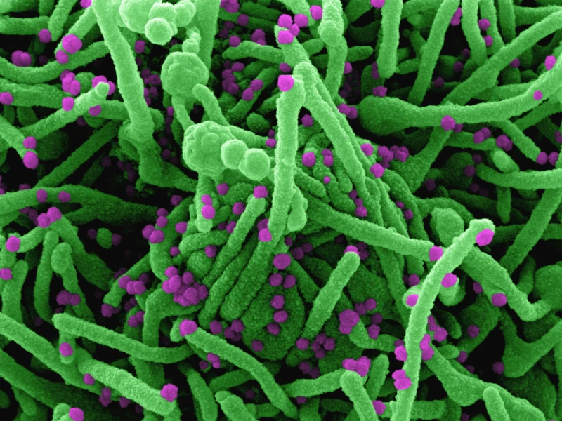 Mikroskopische Aufnahme von Pollen und Zellstrukturen